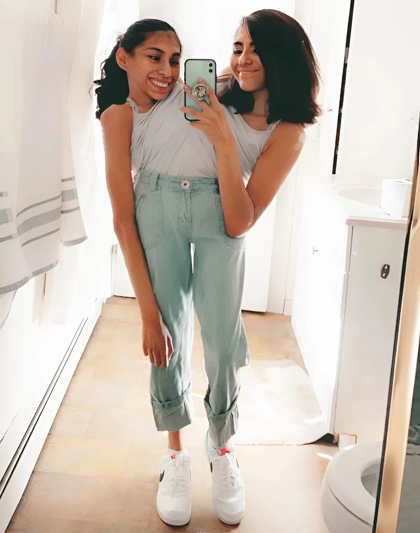 Des jumelles siamoises, reliées au niveau de l’abdomen, ont épousé le même homme : voici à quoi ressemble leur mari