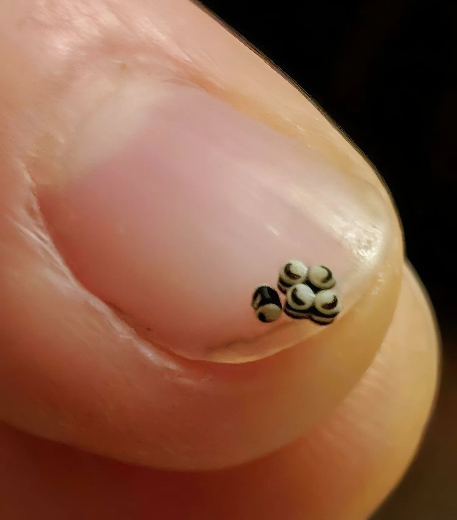 Nous avions commandé une salade, mais il y avait de minuscules grains noirs dans notre plat : nous sommes allés directement à l’hôpital Nous avions commandé une salade, mais il y avait de minuscules grains noirs dans notre plat : nous sommes allés directement à l’hôpital