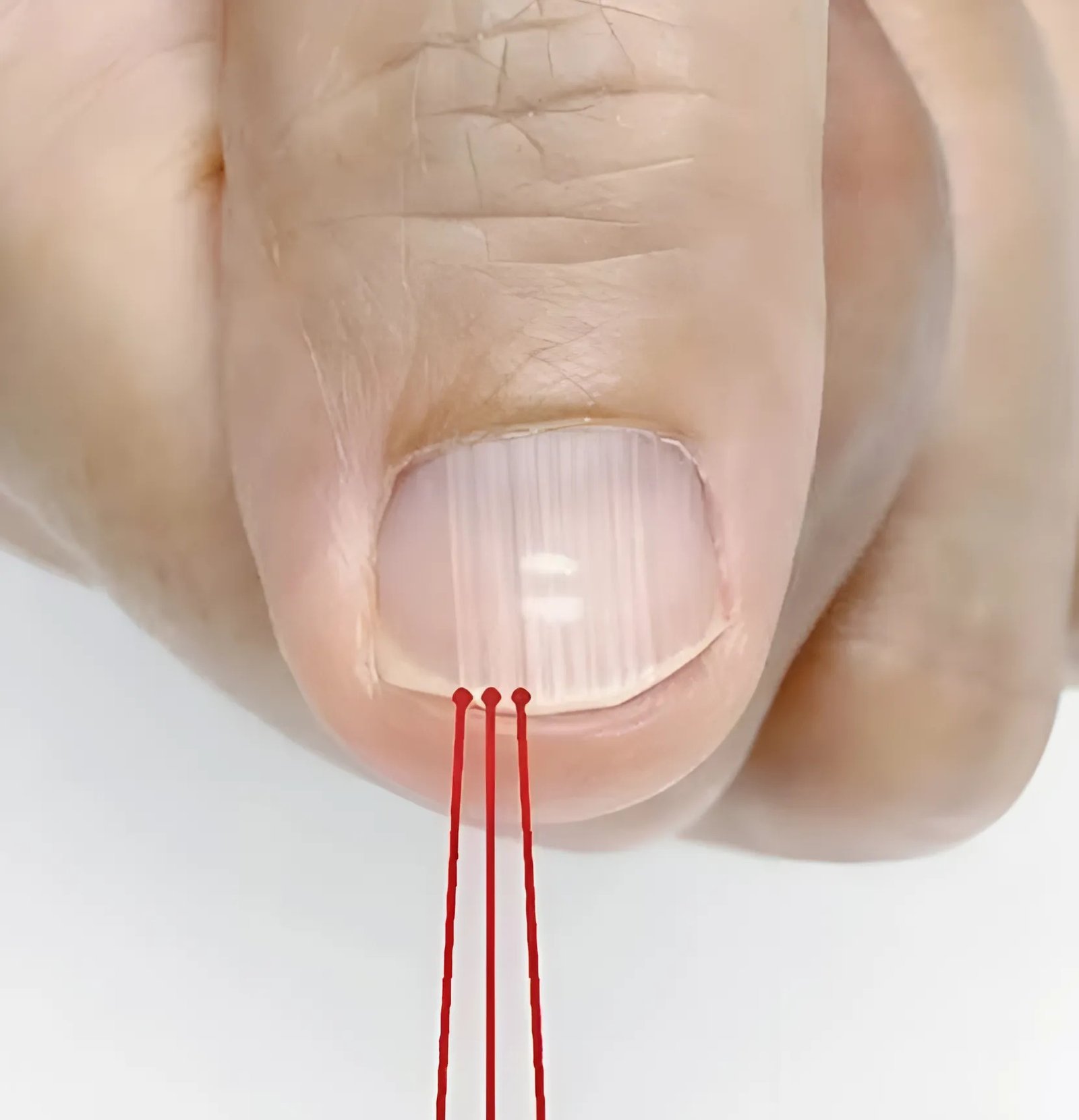 Que signifient vraiment les stries verticales sur les ongles : la vérité va vous surprendre Que signifient vraiment les stries verticales sur les ongles : la vérité va vous surprendre