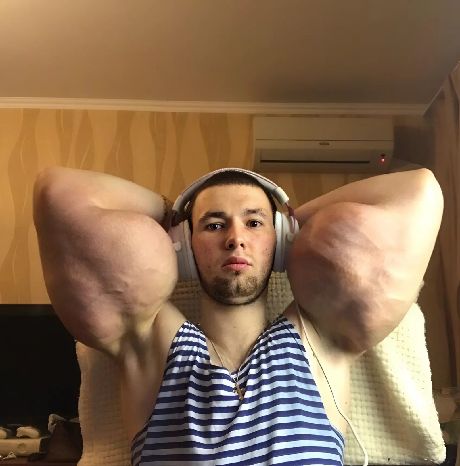 Un homme a grossi ses muscles des bras, mais ne s’est pas arrêté là : il a aussi modifié ses lèvres et ses pommettes: Voici à quoi il ressemble aujourd’hui Un homme a grossi ses muscles des bras, mais ne s’est pas arrêté là : il a aussi modifié ses lèvres et ses pommettes: Voici à quoi il ressemble aujourd’hui