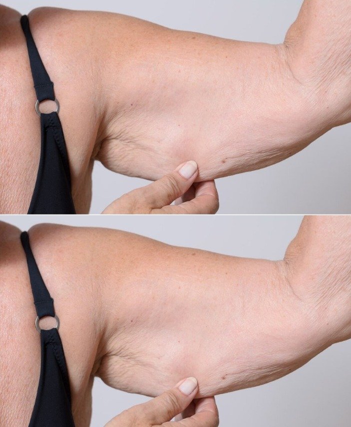 La faiblesse musculaire chez les adultes s’appelle sarcopénie, mais ses conséquences peuvent être évitées : voici comment