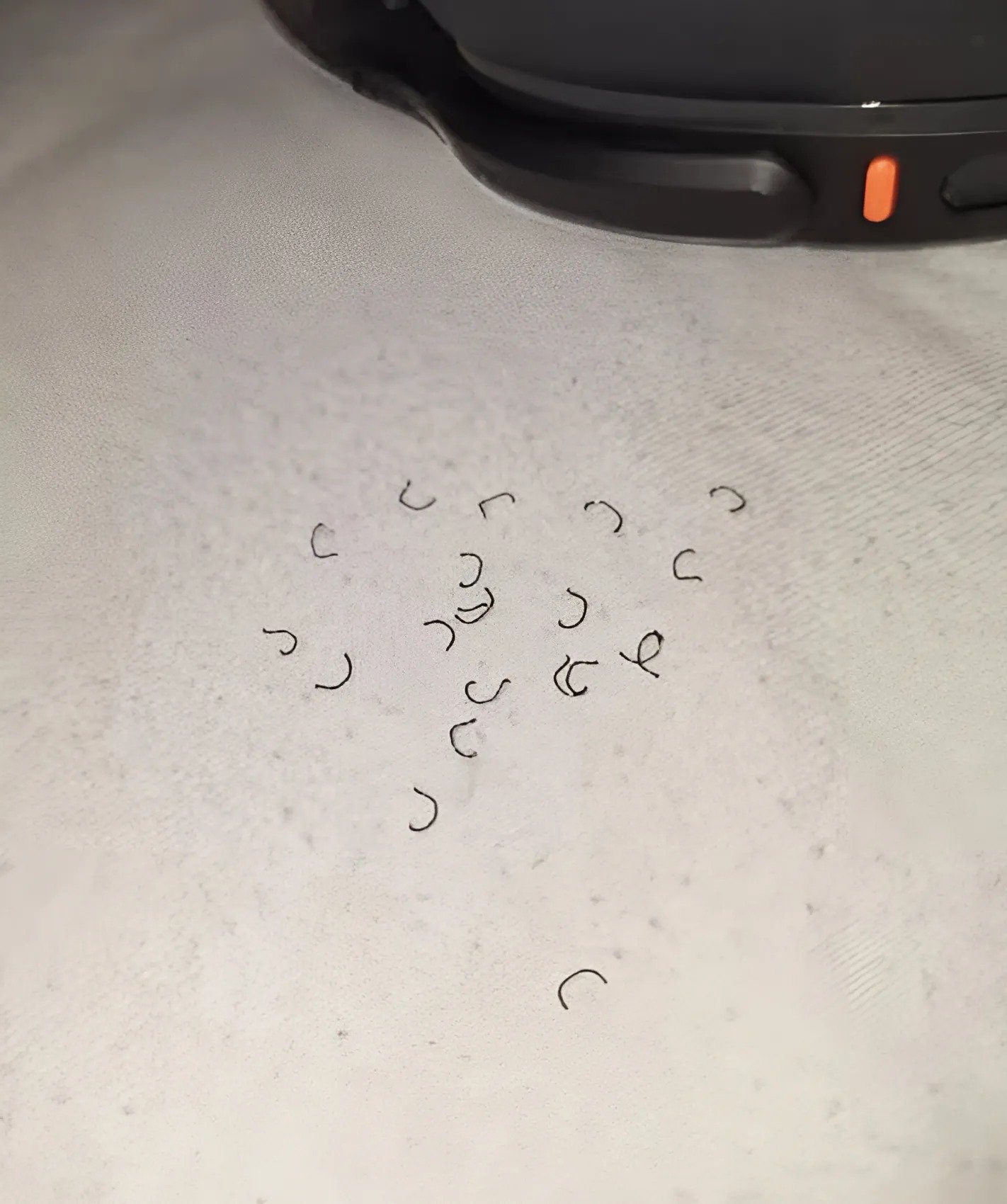 J’ai trouvé ces étranges peluches dans mon lit et je n’arrivais pas à comprendre ce que c’était : vous avez déjà vu ça ?